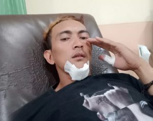 Lagi, Jurnalis Karawang Dianiaya, Mungkinkah Buntut Hakim Halalkan Pasal 170 KUHP ?