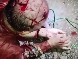 Bersimbah Darah, Pria Paruh Baya Ngaku di Begal